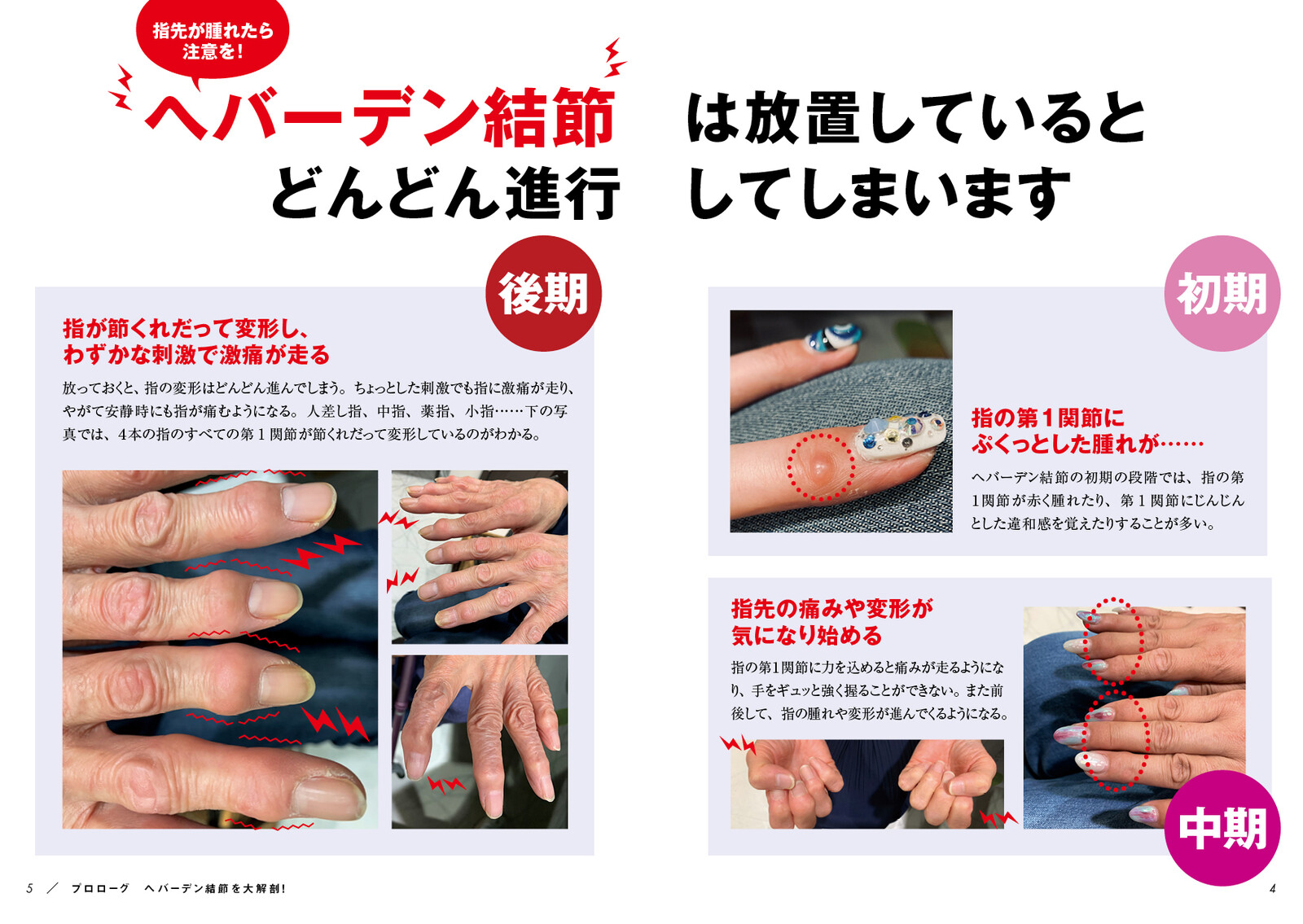 ヘバーデン結節は自分で治せる の商品ページ 卸 仕入れサイト スーパーデリバリー ヘバーデン結節は自分で治せる の商品ページ 卸 仕入れサイト スーパーデリバリー
